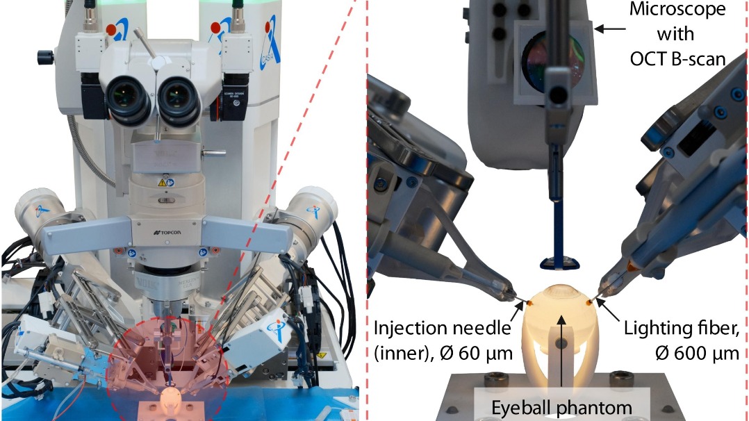 চোখের সার্জারি রোবট বানাল চীন